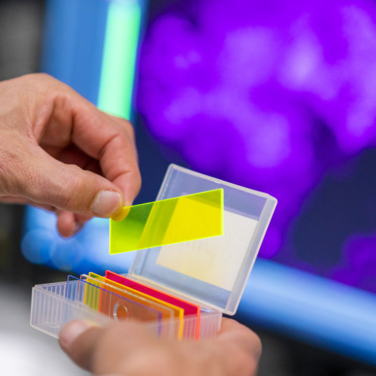 Immune cells block attack on aggressive brain tumors